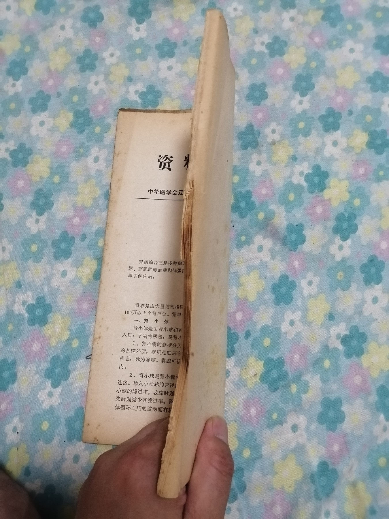 医学资料（肾病综合征）