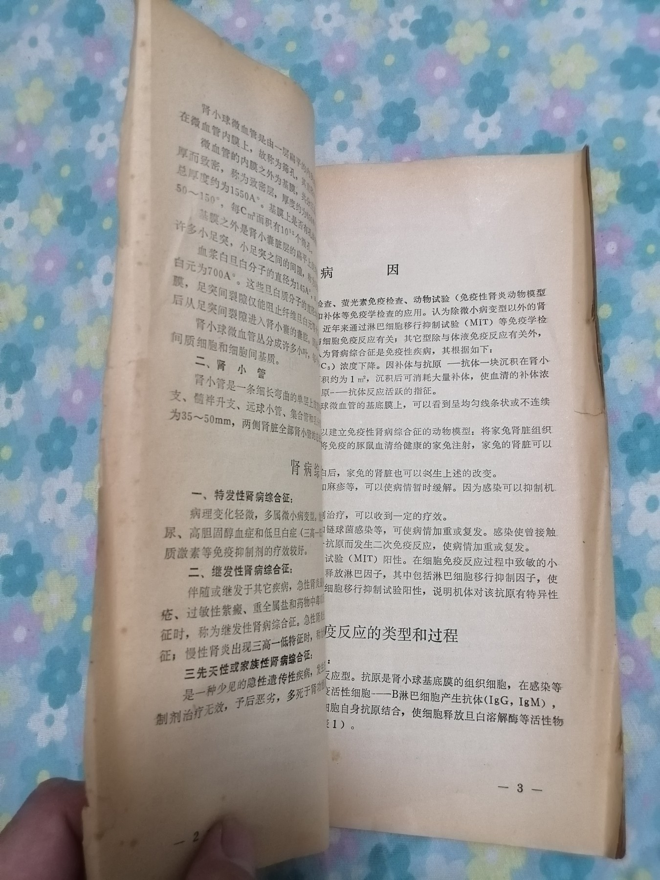 医学资料（肾病综合征）