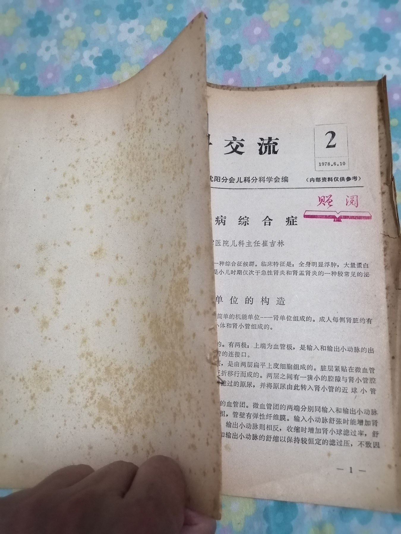 医学资料（肾病综合征）
