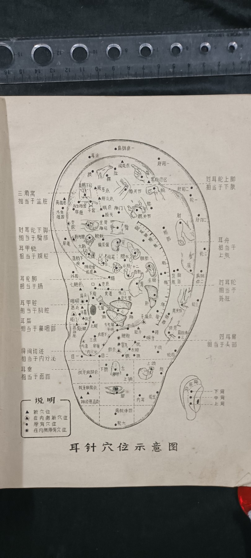 天字一号拍卖，100件拍品全部0起！ 大本wegame中医针灸书籍，赤脚医生