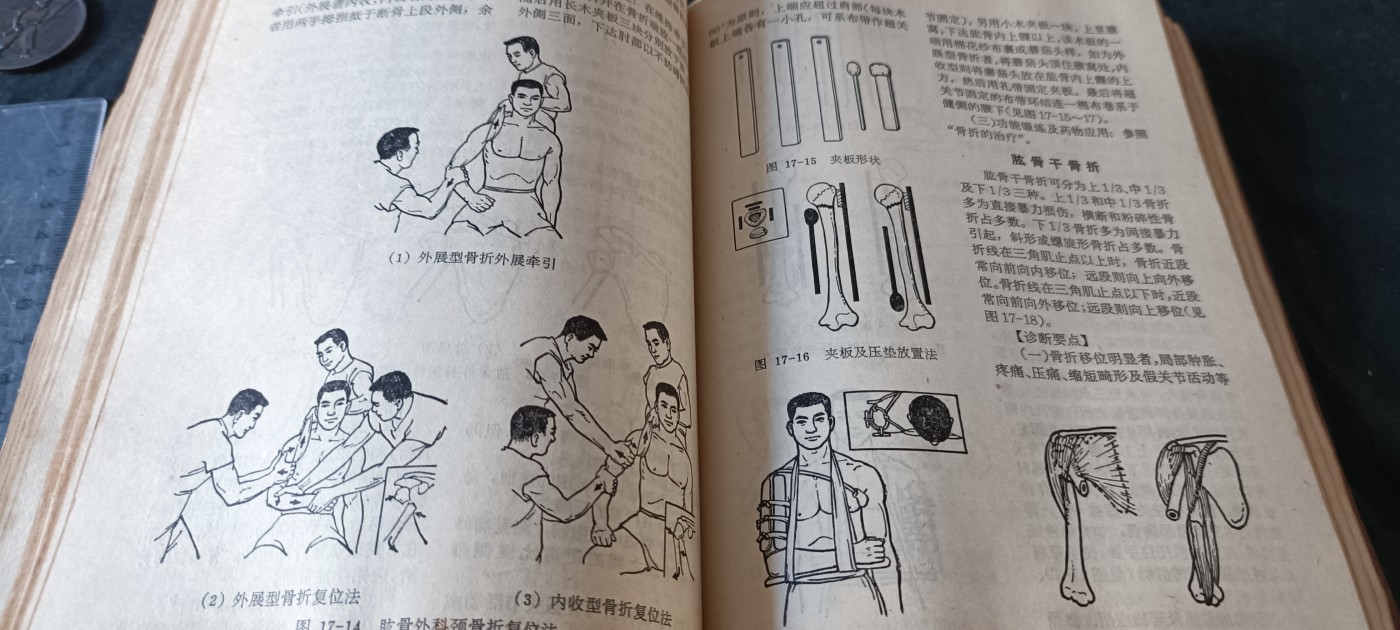 杂项拍卖，满百包邮，可以寄存！ 赤脚医生手册原版老书，最全的一版