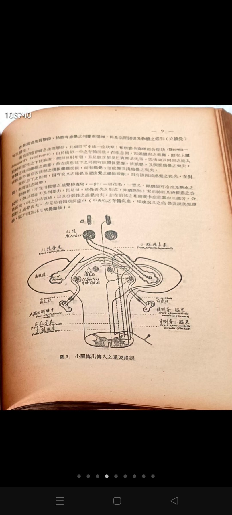下乡淘得五十年代《希氏内科学》，共2本四卷，保存完整：心脏疾病，神经疾病，中毒，心律不齐，心绞痛，淋巴水肿，栓塞，冻疮，关节疾病，骨节疾病，肾脏疾病，尿毒症，肾下垂，腎藏肿瘤，水银中毒，铅中毒，苯中毒，水痘，天花，口蹄病，狂犬病，脑炎，鹦鹉病，麻疹，风疹，肺炎，猩红热，丹毒，霍乱，鼠疫，破伤风，百日咳，肺结核，梅病，虫病，菌病，鼠咬热，滴虫病，疥，蝇病，肝吸虫病，瓜仁虫……包老包真，自然黄旧……