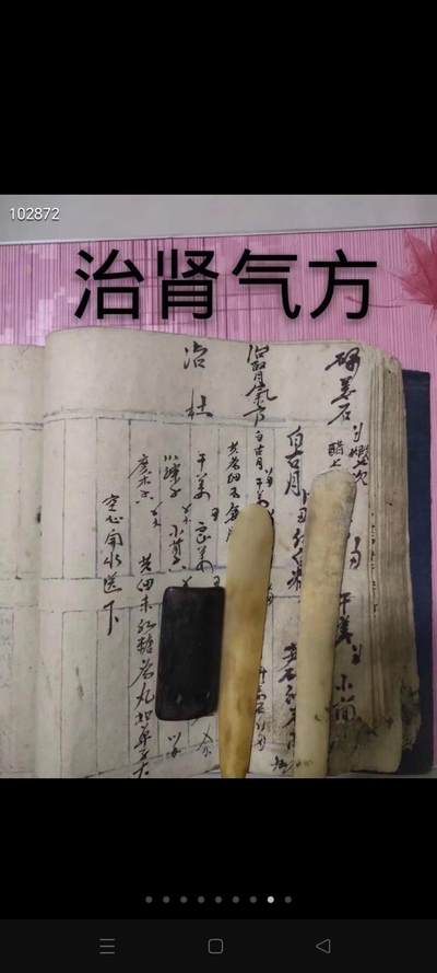 《巨厚大》罕见清代手写《秘方》(孤本)(有残角，品相如图)厚厚160页，主治《治留子方》 治遗精，吊白方，风湿疙瘩作痒洗药方，润肌膏【主治】风寒侵袭皮肤，血不荣于肌表，致成酸痛，手足似无皮之状，偶触衣物，或以手捺，疼痛连心者。阴户疼，煮酒药方，七宗香，《白油羔，京和膏，松香羔等(查无资料书独家秘方)》治不孕不育方，调经种玉汤，接骨洗药，洗眼药，红酒药，黄酒药，等，好多秘方可以申 - 《巨厚大》罕见清代手写《秘方》(孤本)(有残角，品相如图)厚厚160页，主治《治留子方》 治遗精，吊白方，风湿疙瘩作痒洗药方，润肌膏【主治】风寒侵袭皮肤，血不荣于肌表，致成酸痛，手足似无皮之状，偶触衣物，或以手捺，疼痛连心者。阴户疼，煮酒药方，七宗香，《白油羔，京和膏，松香羔等(查无资料书独家秘方)》治不孕不育方，调经种玉汤，接骨洗药，洗眼药，红酒药，黄酒药，等，好多秘方可以申