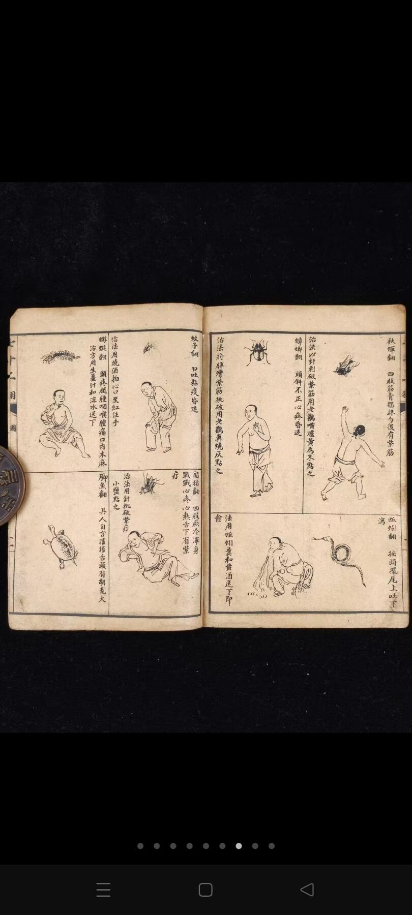 《绘图针灸易学-附七十二翻图说》三册全，民国时期石印本，单本尺寸20/13.4厘米，彩图尺寸59/44.5厘米，品相如图所示！ 是一部针灸著作，卷上为针灸源流、手法和认症三部分，重点介绍了针灸的方法及要穴的应用，符合中医辨证论治的基本法则。卷下记述十四经穴及奇穴。 为人体经络易学与科学权威著作。