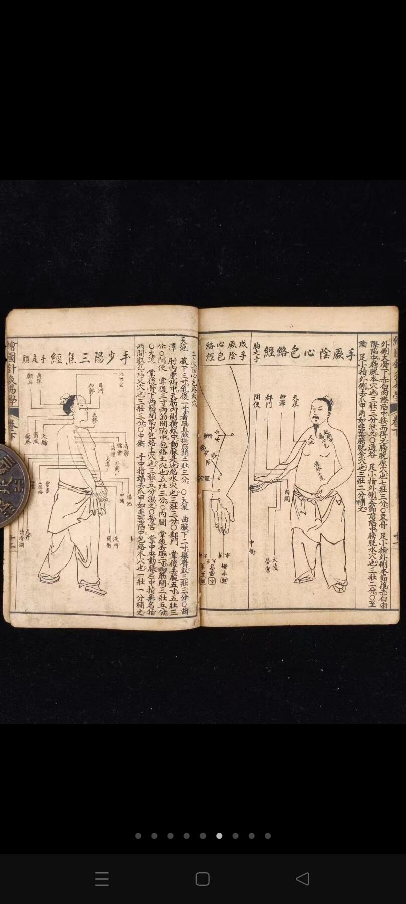 《绘图针灸易学-附七十二翻图说》三册全，民国时期石印本，单本尺寸20/13.4厘米，彩图尺寸59/44.5厘米，品相如图所示！ 是一部针灸著作，卷上为针灸源流、手法和认症三部分，重点介绍了针灸的方法及要穴的应用，符合中医辨证论治的基本法则。卷下记述十四经穴及奇穴。 为人体经络易学与科学权威著作。