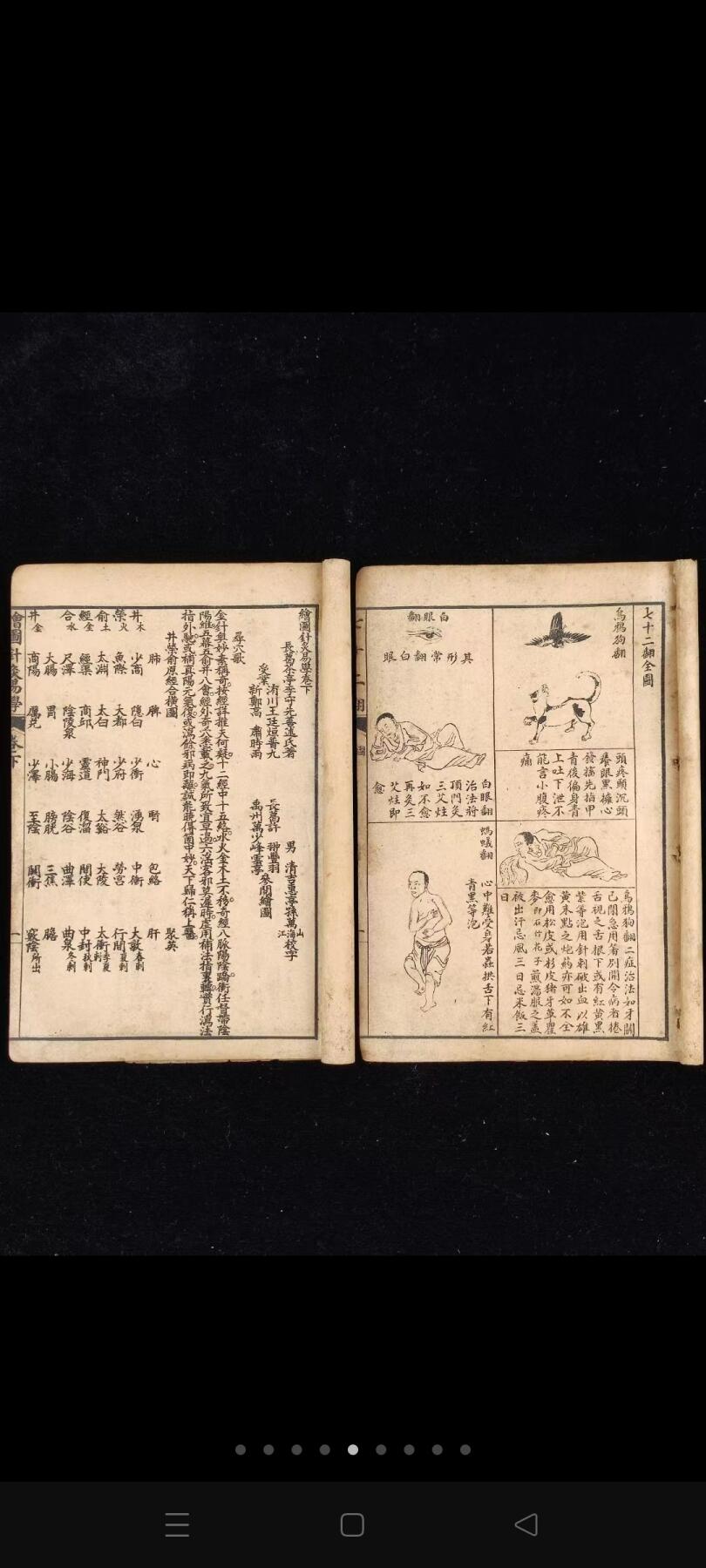 《绘图针灸易学-附七十二翻图说》三册全，民国时期石印本，单本尺寸20/13.4厘米，彩图尺寸59/44.5厘米，品相如图所示！ 是一部针灸著作，卷上为针灸源流、手法和认症三部分，重点介绍了针灸的方法及要穴的应用，符合中医辨证论治的基本法则。卷下记述十四经穴及奇穴。 为人体经络易学与科学权威著作。