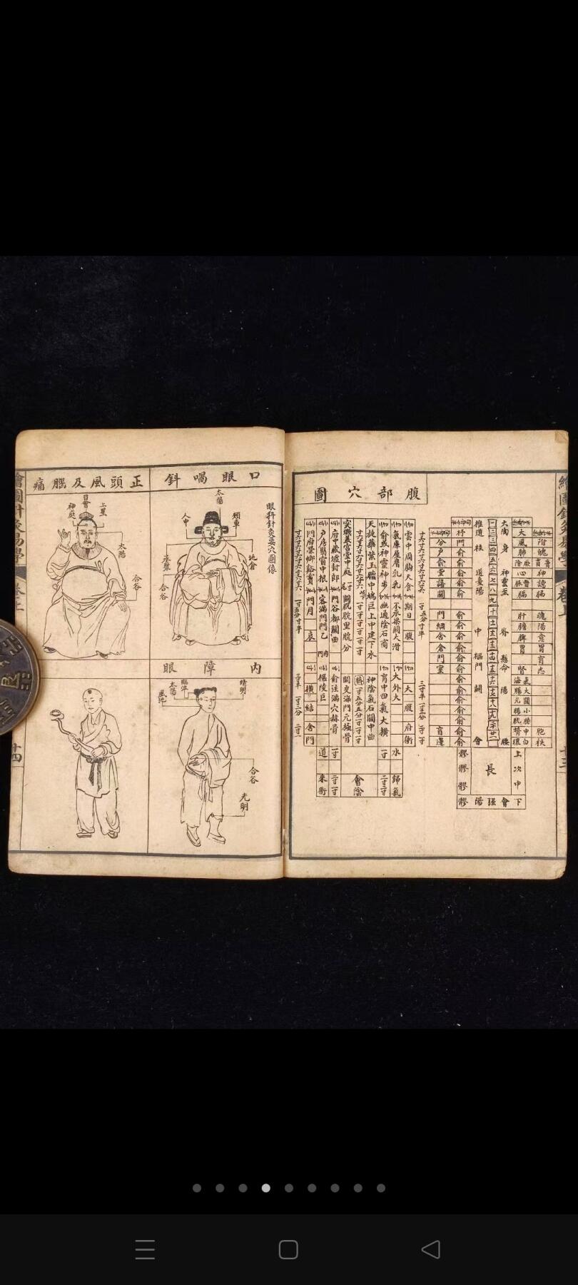 《绘图针灸易学-附七十二翻图说》三册全，民国时期石印本，单本尺寸20/13.4厘米，彩图尺寸59/44.5厘米，品相如图所示！ 是一部针灸著作，卷上为针灸源流、手法和认症三部分，重点介绍了针灸的方法及要穴的应用，符合中医辨证论治的基本法则。卷下记述十四经穴及奇穴。 为人体经络易学与科学权威著作。