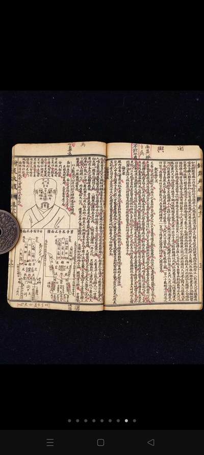 《增补绘图针灸大成》一套六册十二卷全，都门杨氏秘藏原本，上海共和书局石印，20.2/13.6厘米，品相如图所示！ - 《增补绘图针灸大成》一套六册十二卷全，都门杨氏秘藏原本，上海共和书局石印，20.2/13.6厘米，品相如图所示！