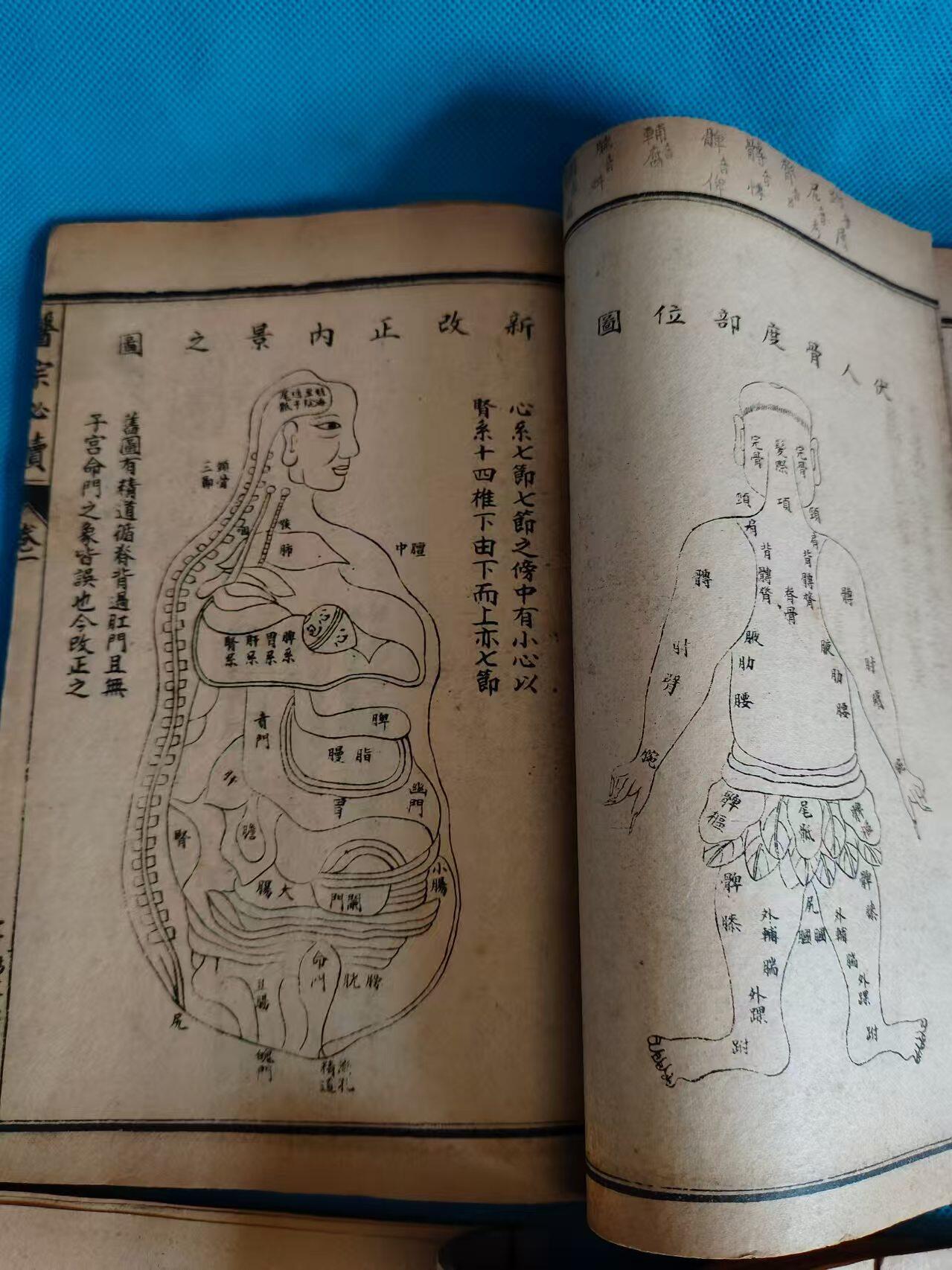 清代崇祯丁丑春仲版中医古籍，童氏重校，校正医中必读，六册十卷全集，附图说明，脉诀心法，色诊十论，内外科杂症，痿症，痹症，恐症，喘症，遗精淋病，不得卧症，霍乱等