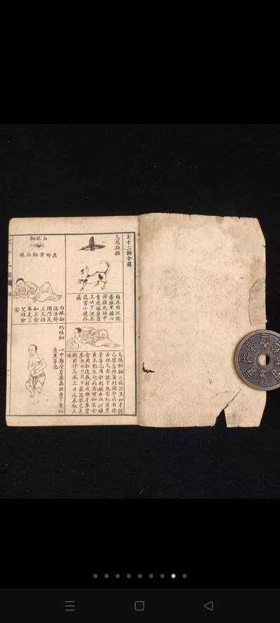 《绘图针灸易学-附七十二翻图说》一函三册全，民国时期石印本，单本尺寸20/13.4厘米，品相如图所示！ 是一部针灸著作，卷上为针灸源流、手法和认症三部分，重点介绍了针灸的方法及要穴的应用，符合中医辨证论治的基本法则。卷下记述十四经穴及奇穴。 为人体经络易学与科学权威著作。 - 《绘图针灸易学-附七十二翻图说》一函三册全，民国时期石印本，单本尺寸20/13.4厘米，品相如图所示！ 是一部针灸著作，卷上为针灸源流、手法和认症三部分，重点介绍了针灸的方法及要穴的应用，符合中医辨证论治的基本法则。卷下记述十四经穴及奇穴。 为人体经络易学与科学权威著作。