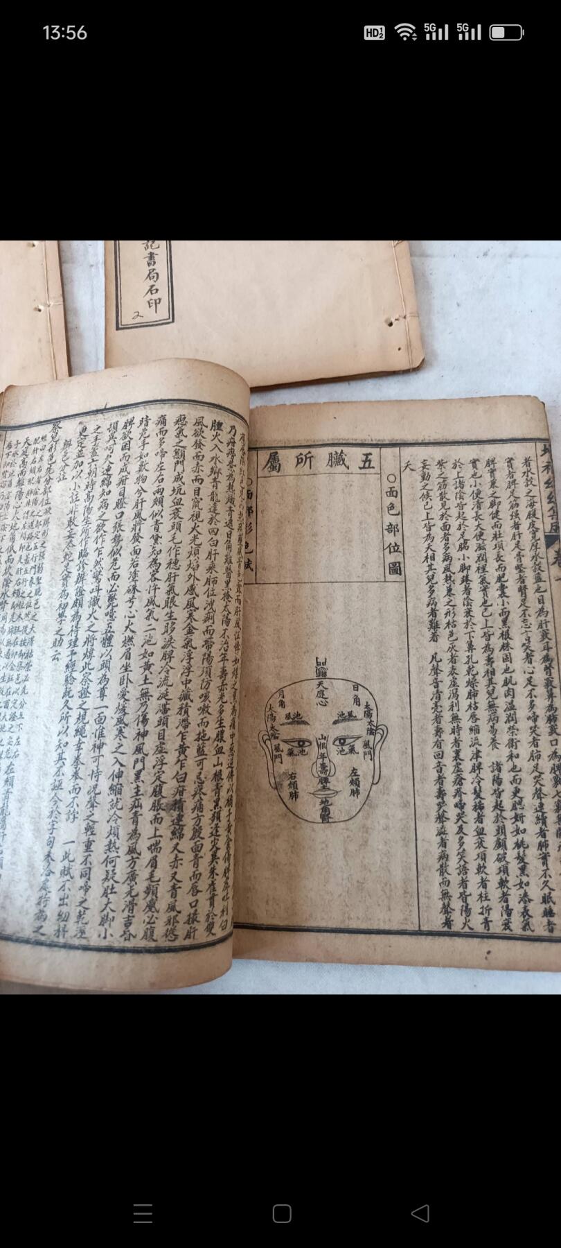 《幼幼集成》清代名医陈复正著，石印版，共6本六卷，专治小儿科医书，保存完整，少见，包老！
