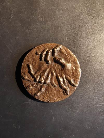 老王徽章第167期 - 法国1981年国际风湿病学大会大铜章     直径68mm.    重量186.1g