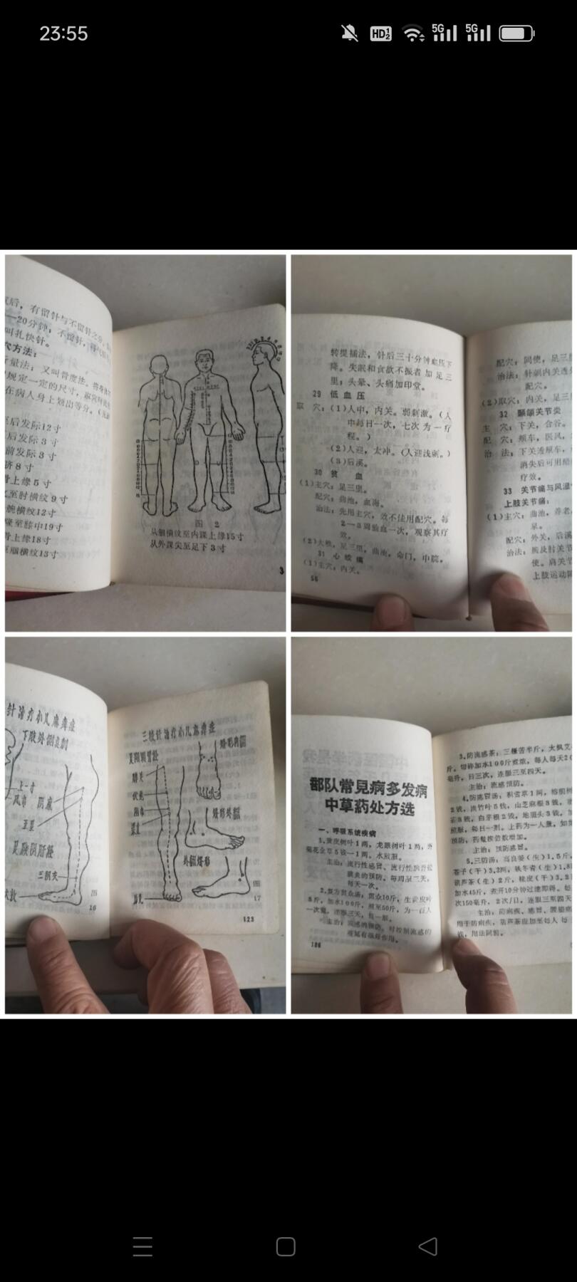 一九六九年浙江省温州军分区后勤卫生科编印（新医疗法经验汇编）1本。内有插图和题词，共336页。如图包老