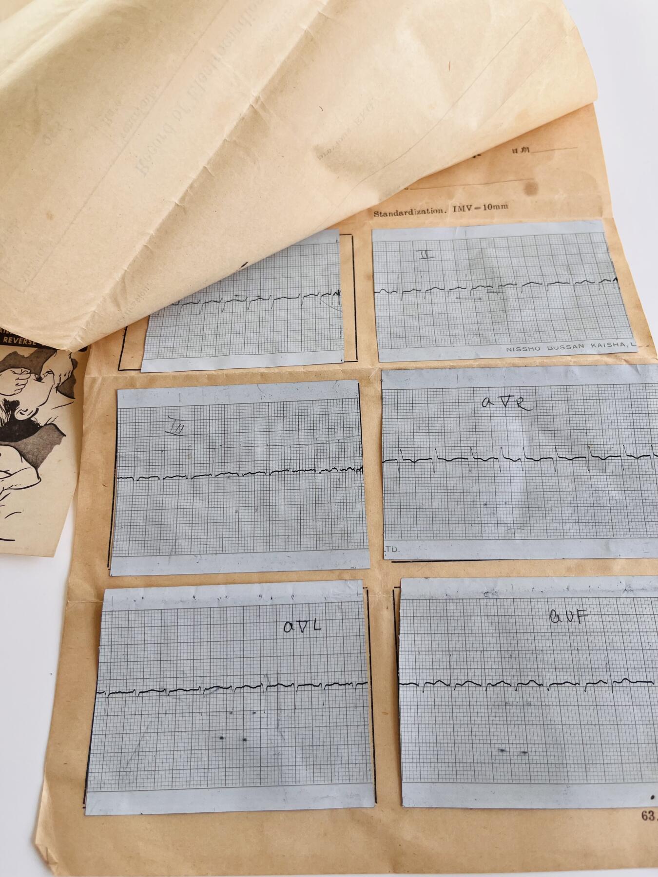 韵星假日军品类拍卖第40期 -- Rimey Holidays Militaria Auction 40 海军澎湖基地医院心电图体检报告、示意卡片等一组